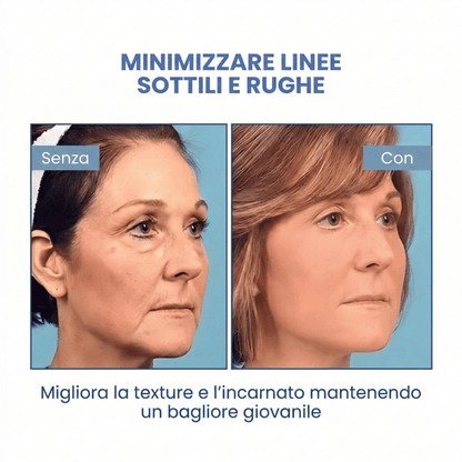 SkinLift™ | Siero Viso Botox
