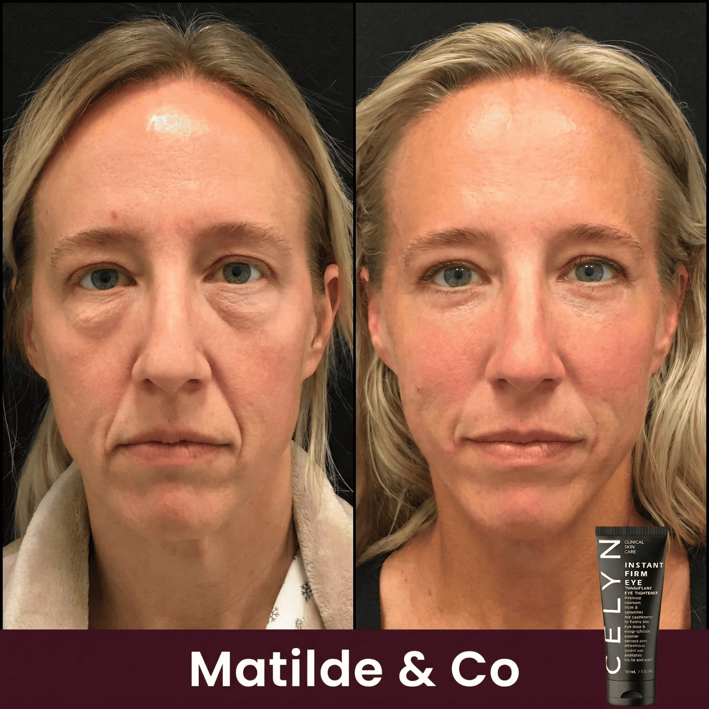 Crema Occhiaie e Rughe Istantanea