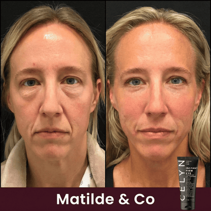 Crema Occhiaie e Rughe Istantanea