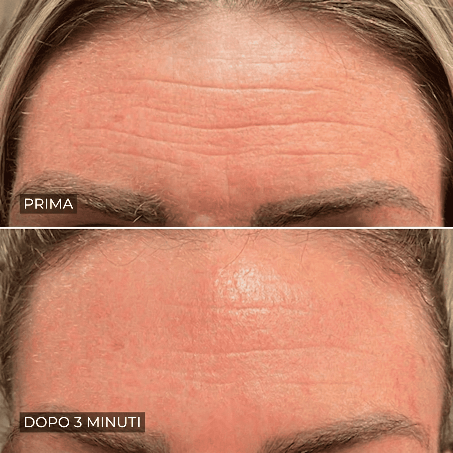 Eline™ - Levigante Rughe