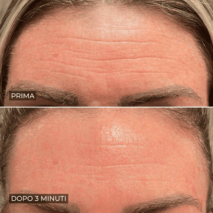 Eline™ - Levigante Rughe