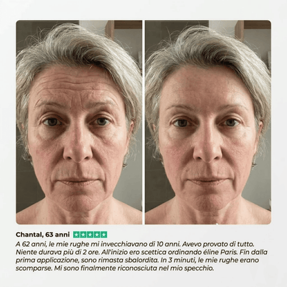 Eline™ - Levigante Rughe