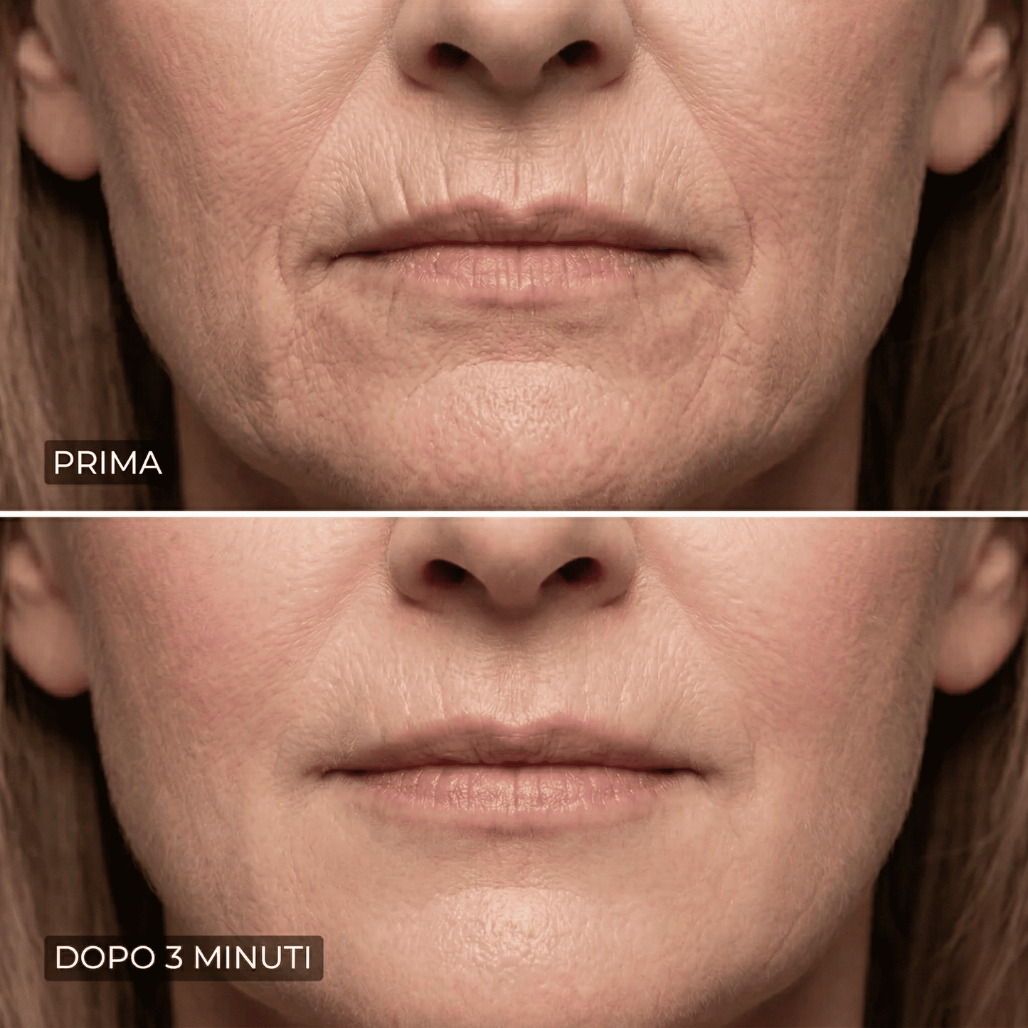 Eline™ - Levigante Rughe